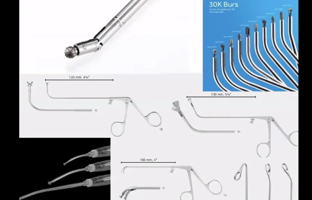 福教授会依据肿瘤的具体位置来挑选适宜的角度镜