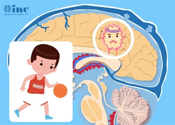 脑膜转移性肿瘤主要病因、治疗方法和治疗时间