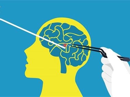 继发性癫痫病的食谱及危害，克星是什么？