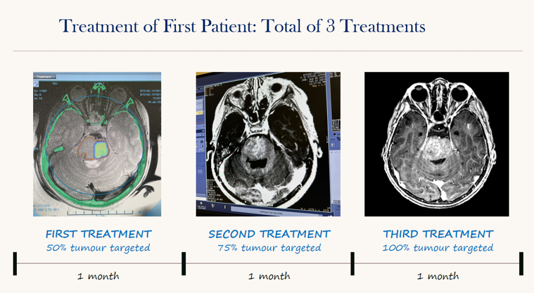 一个月内成功治疗