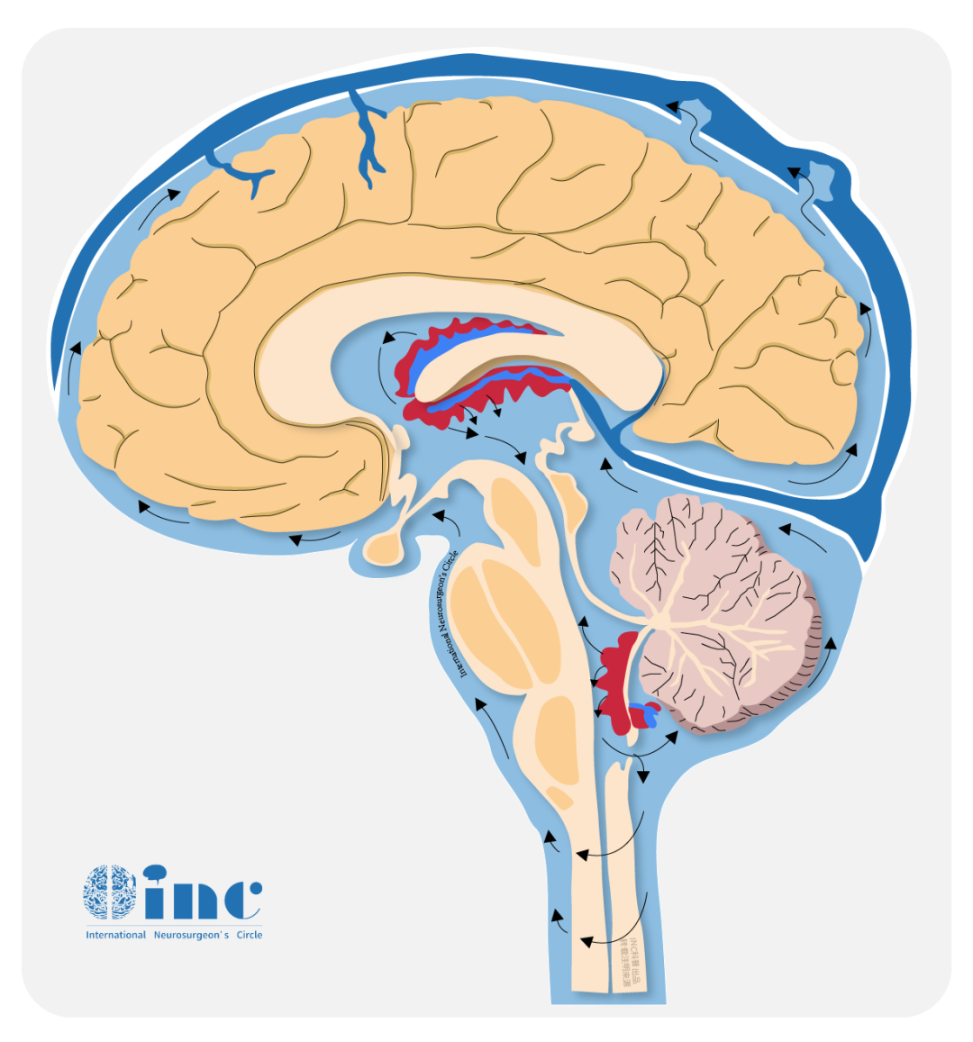 正常情况下，脑脊液不断产生又不断被吸收回流至静脉，以维持颅内脑脊液量的平衡，当脑脊液产生过多或因循环路径受阻导致脑脊液吸收障碍时，就会出现脑积水。