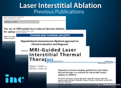 INC国际小儿神外鲁特卡（Rutka）教授学术沙龙：癫痫手术治疗的前沿进展