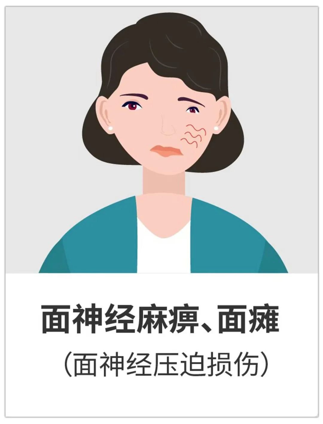 可在早期出现面神经麻痹，偶伴面肌痉挛。