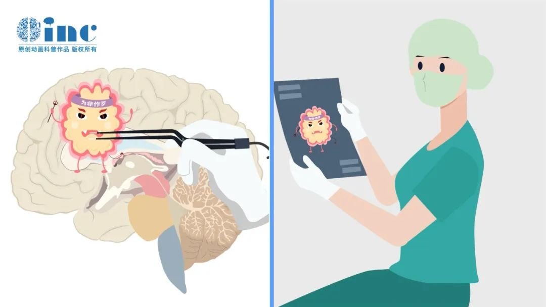 胶质瘤分子病理诊断共识更新，18个诊断意义的基因分子深度解读（下）！
