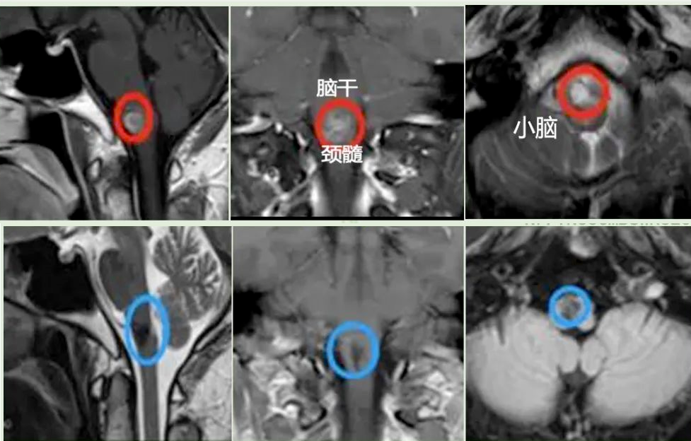 术前术后影像对比，第一排为术前，第二排为术后。