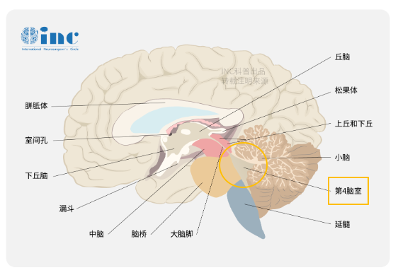第四脑室