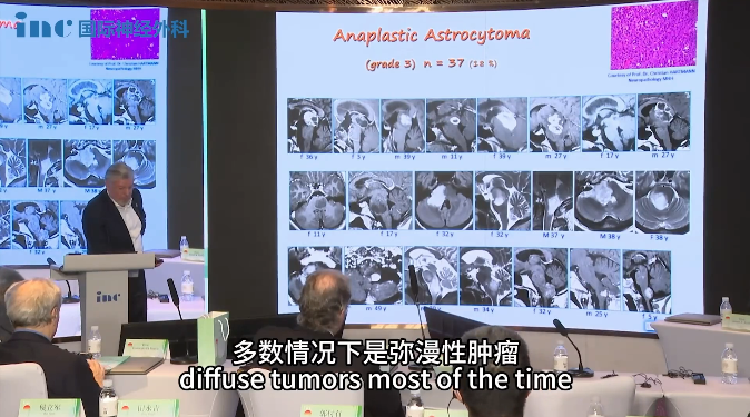 INC巴特朗菲教授