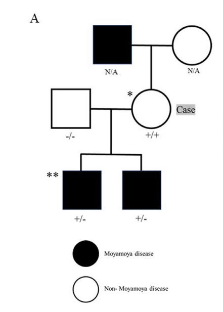 携带RNF213 p.R4810K杂合子变异（