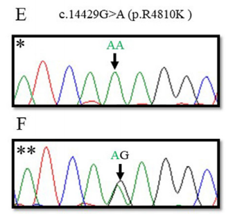 携带RNF213 p.R4810K杂合子变异（