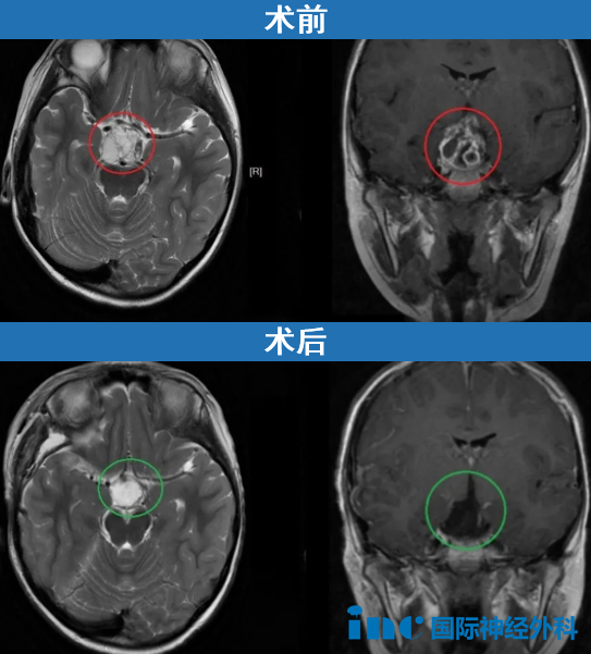 点击图片了解小迪的故事