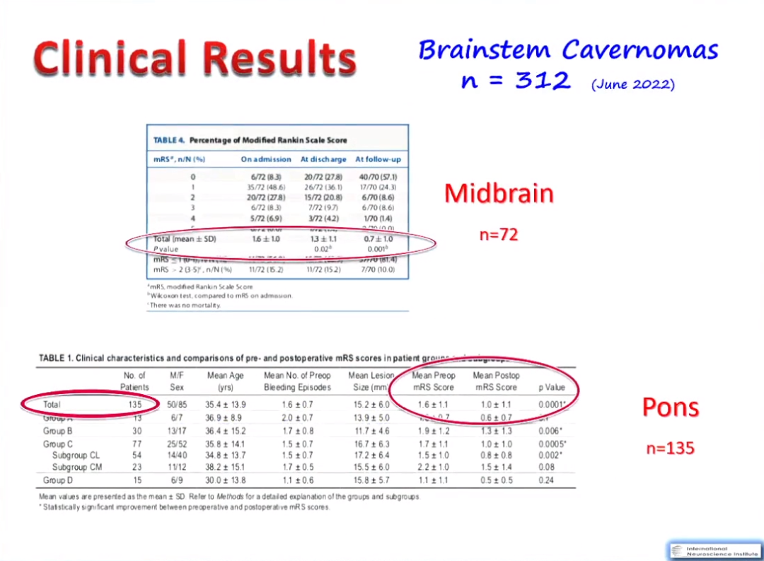脑干海绵状血管瘤手术治疗要点总结