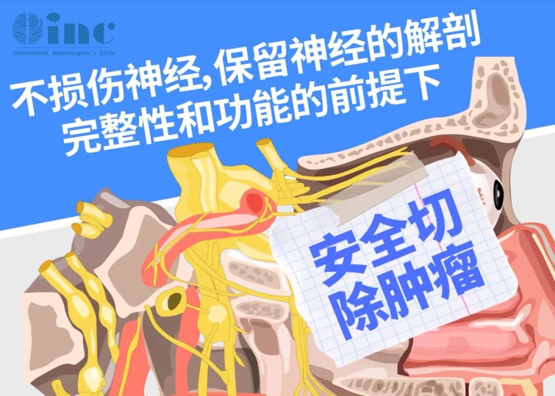 听神经瘤手术如何治疗能够“保听保面”？