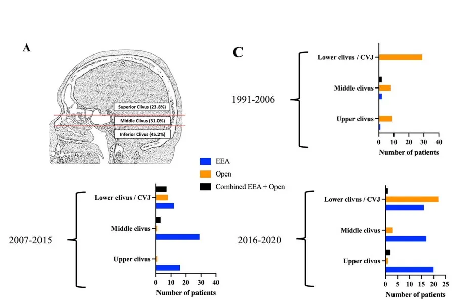 三个不同时期(1991-2006年、2007-2015年、2016-2020年)手术入路的演变过程。