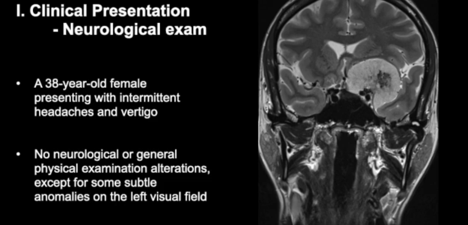 这一次，面对这个特殊的病例，这位擅长"双镜联合"的手术专家将如何见招拆招？