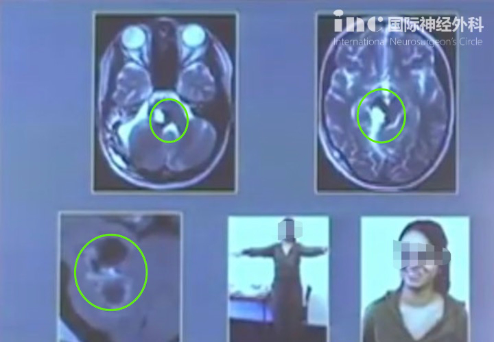 图片中的女孩已经站了起来。