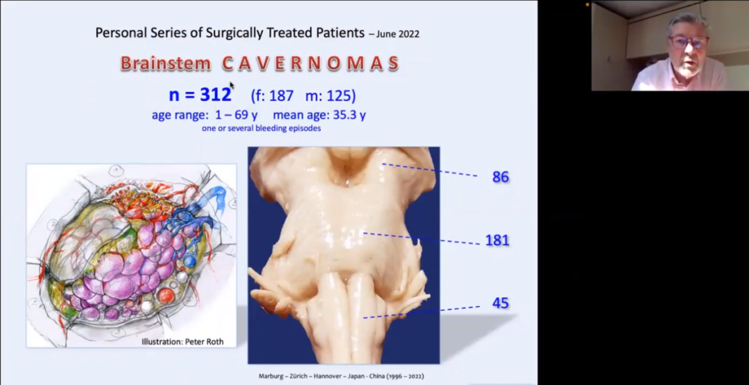 INC Helmut Bertalanffy(巴特朗菲)教授