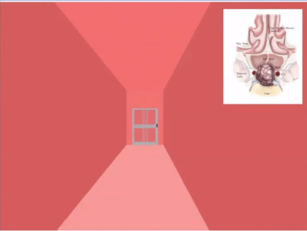 下图为一个我常用的概念图，这个门类似蝶窦前壁，是我们想打开的位置，我们想进入蝶窦腔。