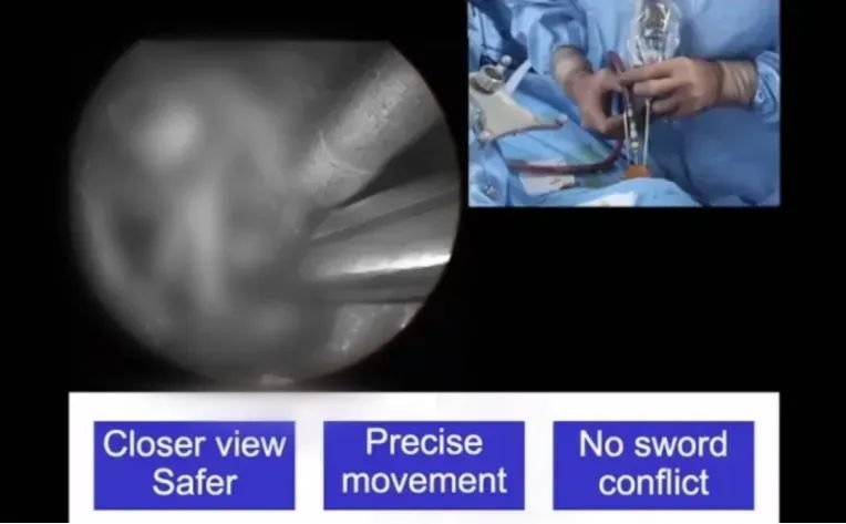 操作时，移动非常精确的，实际上我并不是在用双手操作。那么我虽然不能用双手操作，但是我另一侧是稳定的。