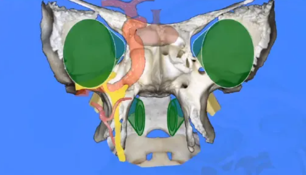 斜坡区肿瘤为何难以手术?