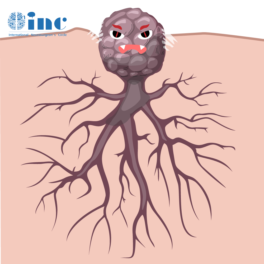 症状越重，手术风险越高，术后功能恢复也越困难。