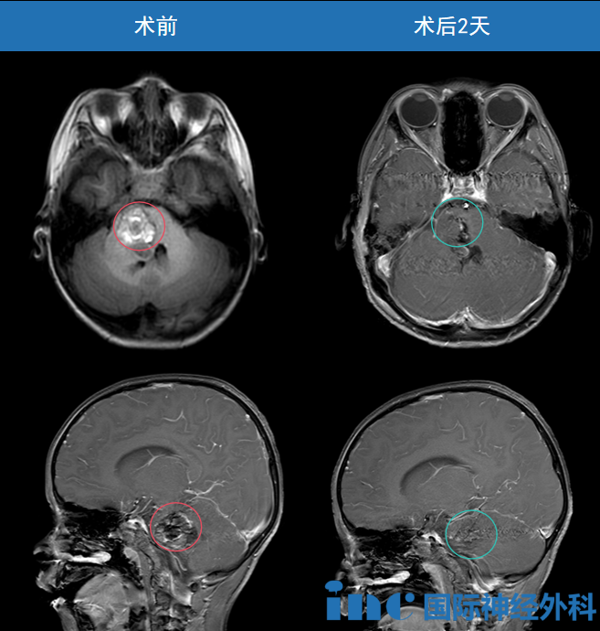 淼淼术前术后影像对比