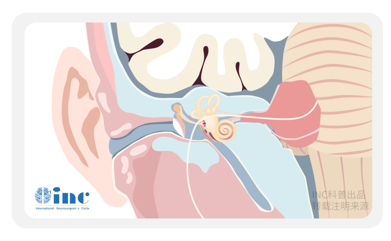 小小耳鸣竟查出2个听神经瘤？这些方法可以帮助你鉴别诊断！