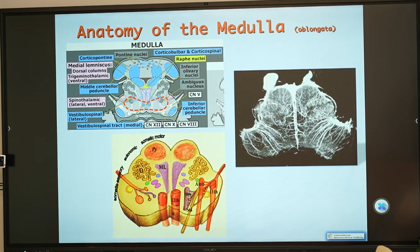 延髓海绵状血管瘤