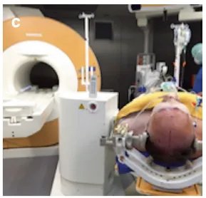 菲恩被安置于专用手术台