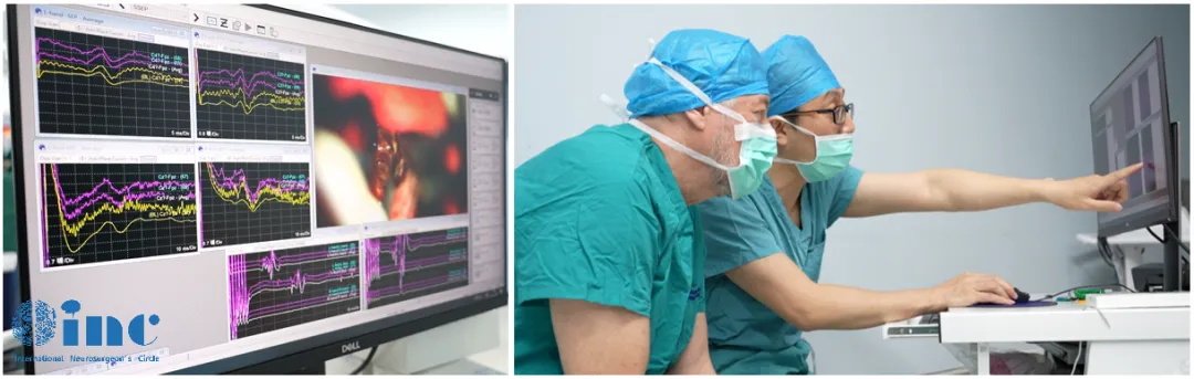 巴教授示范手术中一名患者的监测过程