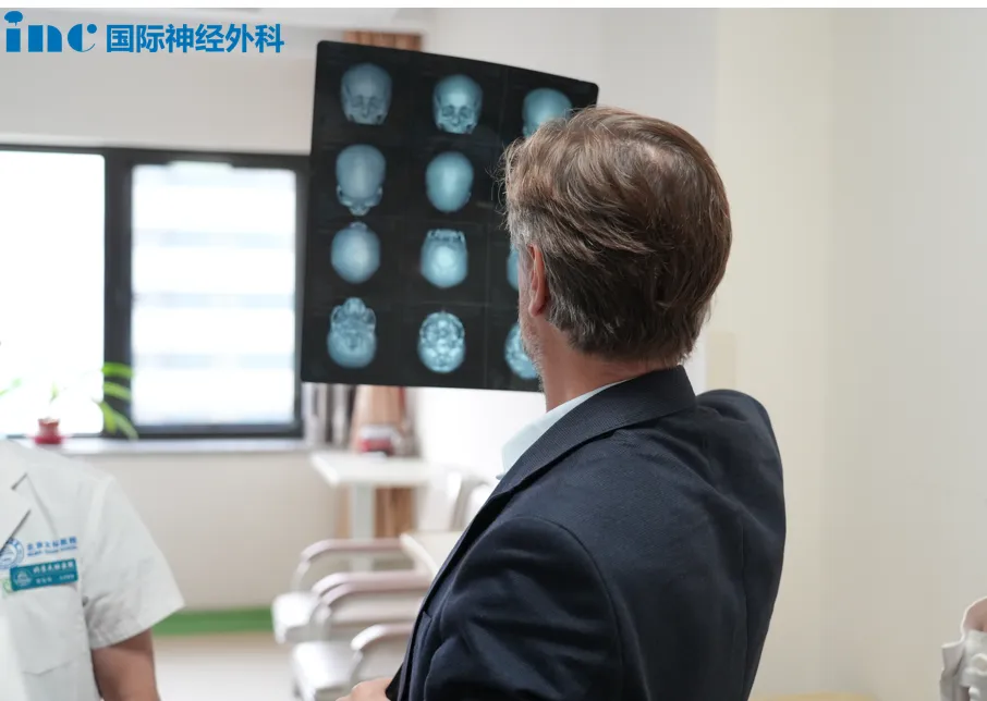 儿童脑瘤为何没有尽早发现？这个脑膜瘤“第一次出手”，竟骗过了所有人