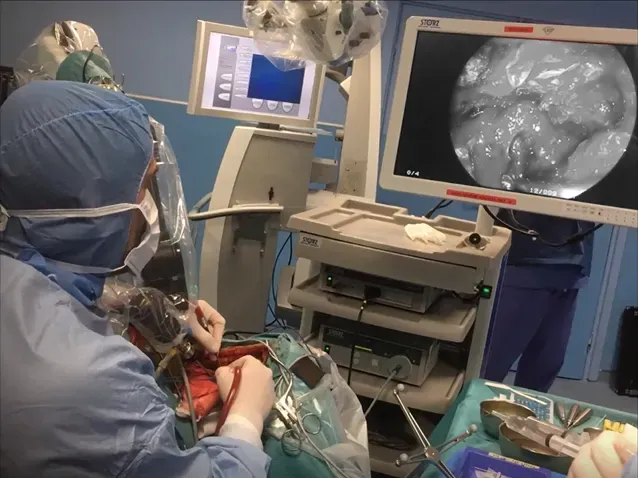 01神经内镜：高清探查肿瘤