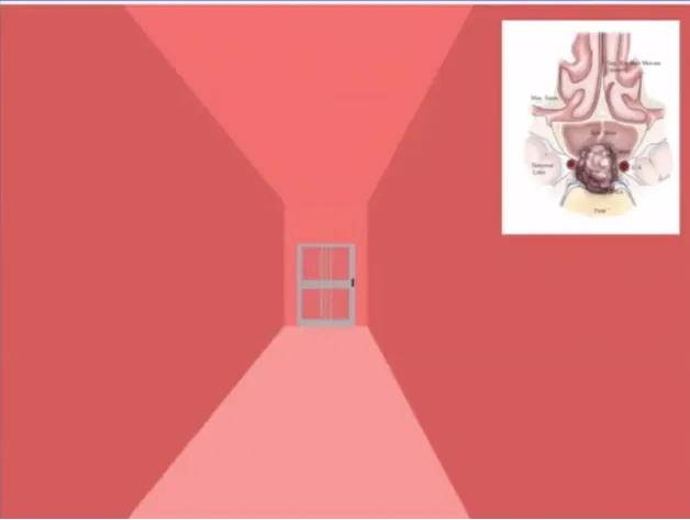 下图为一个福教授常用的概念图，这个门类似蝶窦前壁，是我们想打开的位置，我们想进入蝶窦腔。