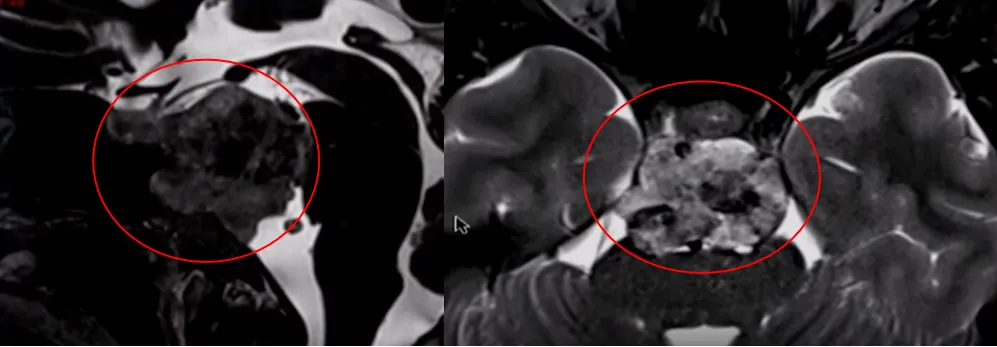 “筷子技术”多重要？