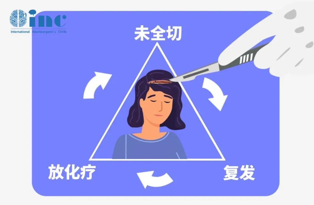 中小型听神经瘤治疗策略，观察、手术还是放疗？