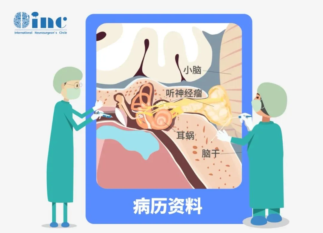 中小型听神经瘤治疗策略，观察、手术还是放疗？