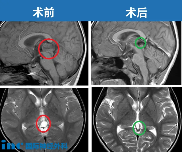 磁共振（MRI）