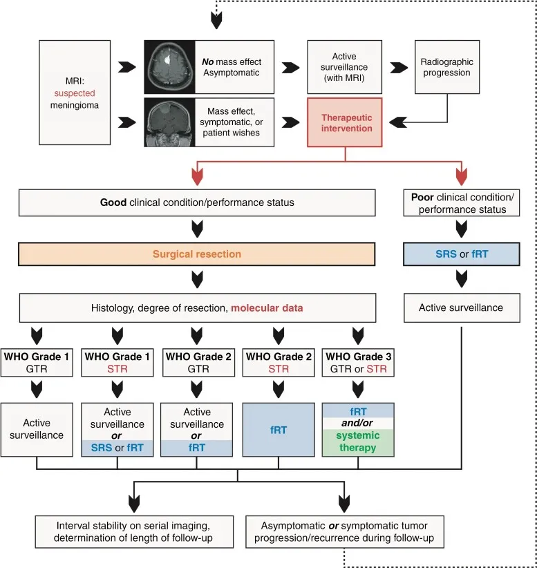 1级脑膜瘤全切VS不全切
