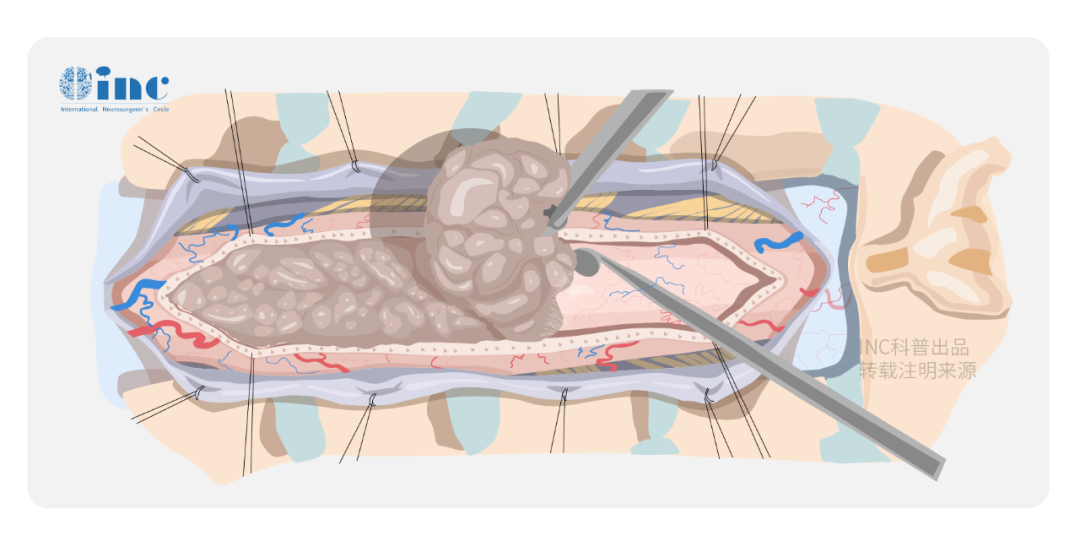 21岁生日那天，我再次紧急出血被送医，可医生却比我还慌……