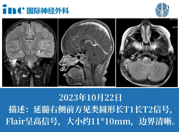 拇指大的 “生命中枢” 藏危机？出现这些症状要警惕！