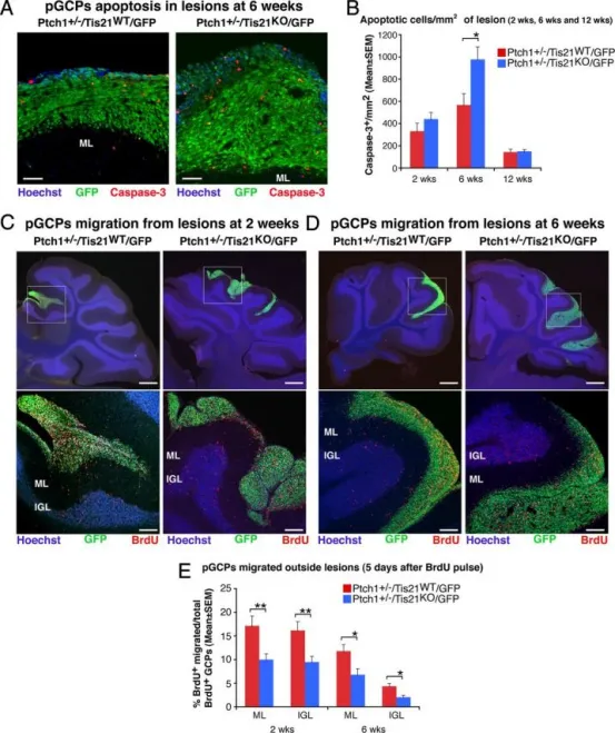 Tis21缺失在Patched1杂合子小鼠中增加前肿瘤性GCP的凋亡并阻碍其迁出病变区