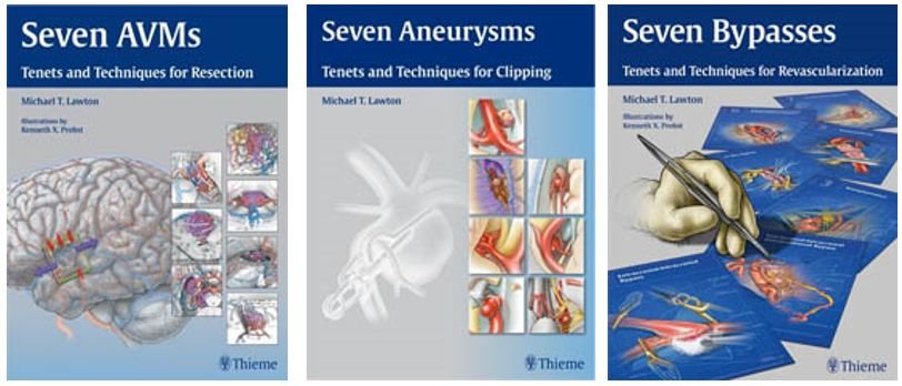 （动脉瘤手术治疗着作《七种脑动静脉畸形：切除原理和技巧》、《七种动脉瘤：夹闭术的原理和技巧》、《七种搭桥术：血运重建的原则和技术》）