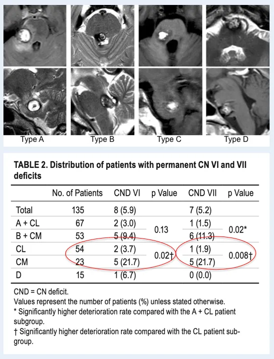 桥脑海绵状血管瘤案例