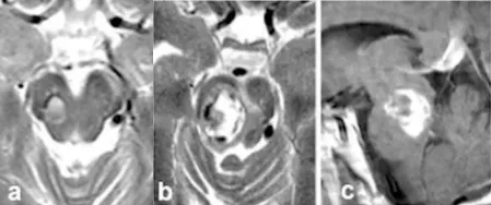 长期熬夜工作后脑出血昏迷，医生竟查出不得了的东西……