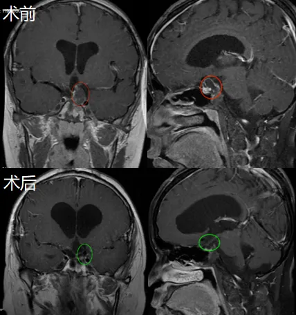 当一个与脑瘤「共存」15年的男孩决定做个了断……