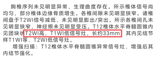 术前核磁检查报告