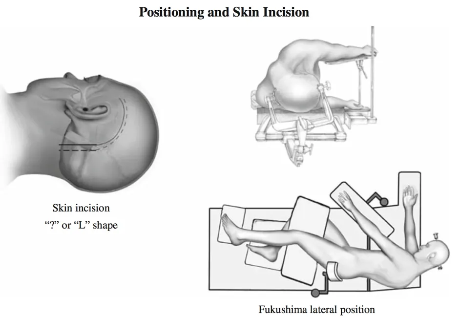 图1：患者头位和体位