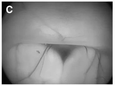 (C)第三脑室底，可见乳头体。