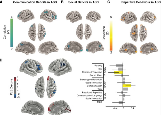 小脑缄默综合征与自闭症