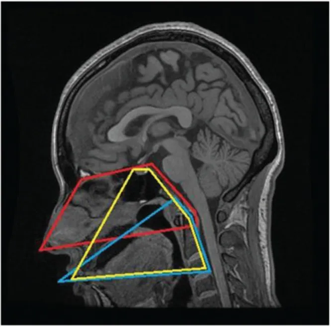 图示：在MRI的矢状中位面上每种方法的局限性