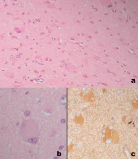 图3代表性组织病理图像：